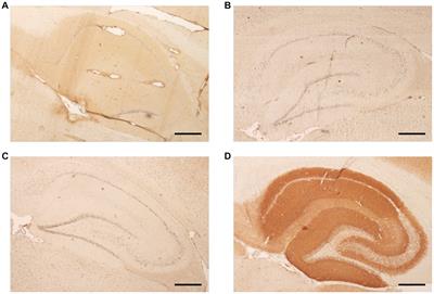 No evidence of neuronal/glial autoantibodies in febrile infection-related epilepsy syndrome (FIRES): a prospective clinic-serologic analysis